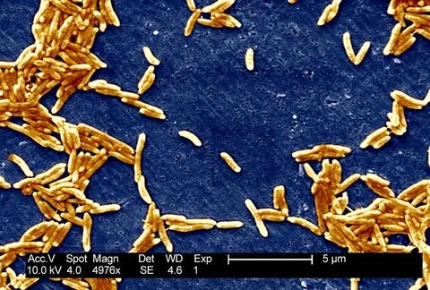  Campylobacter fetus This scanning electron micrograph depicts a grouping ... Stock Photos