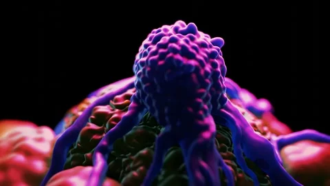 Cancer cell Stock Footage 284048296