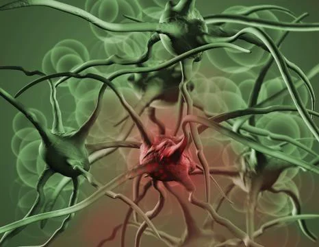 Cancer cell Stock Illustration
