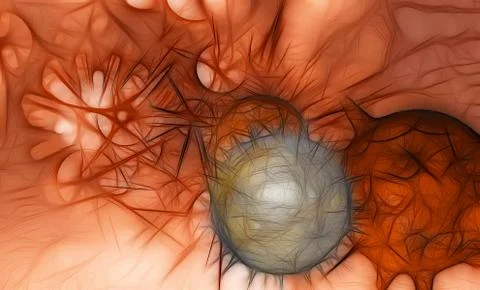 Cancer cell Stock Illustration