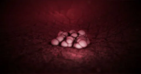 Cancer Cells Growth Stock Footage 86424778