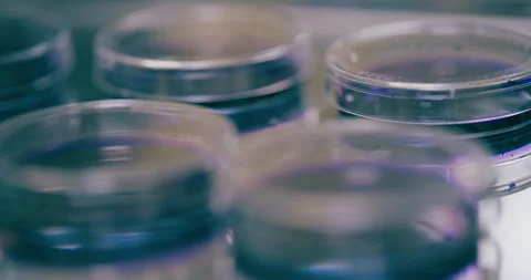 Cancer Cells Under Microscope At Laboratory Stock Footage 241266477