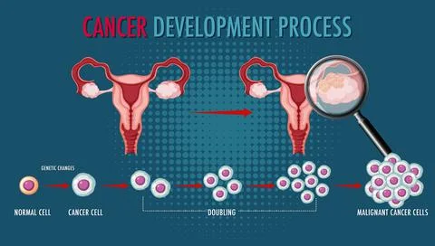 Cancer development process infographic Stock Illustration