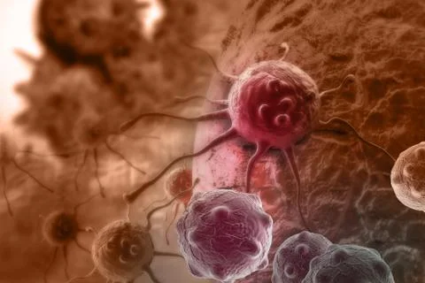 Cancer Stock Illustration