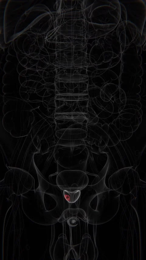 Cancer in prostate area in Vertical X-Ray Video | Prostate Cancer Indication in Stock Footage 301877420