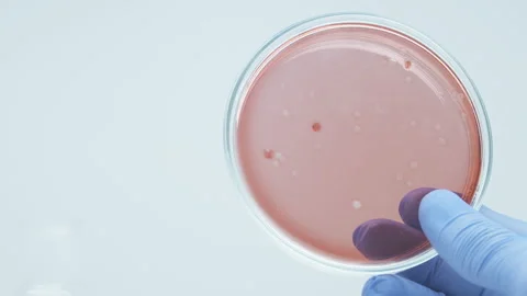 Candida auris. Video stock 242806308