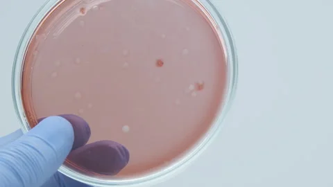 Candida auris. Stock Footage 270081421