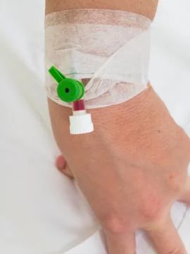 Cannula in hand close up Stock Photos