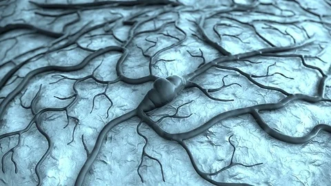 Capillary and stroke Stock Footage 77359394