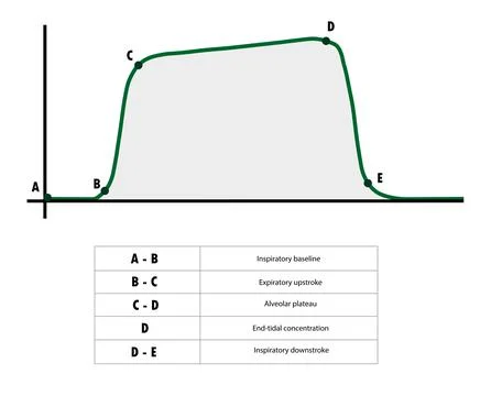 CAPNOGRAPHY WAVEFORM - Stages Stock Illustration