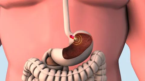 Capsule endoscopy and wireless communication Stock Illustration