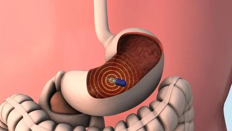 Capsule endoscopy and wireless communication Stock Illustration