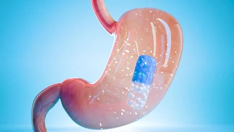 Capsule pill inside human stomach showing digestion process, treatment Stock Footage 317296377