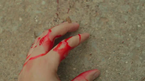 Car accident injury blood bloody hand 3 Stock Footage