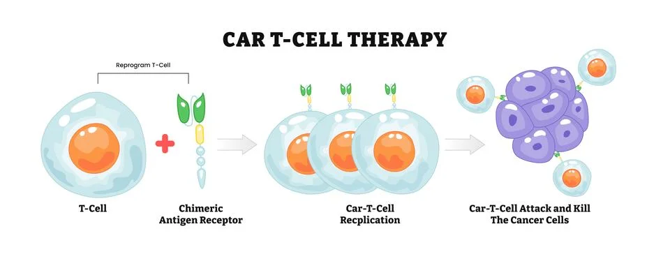 Car T-cell Therapy process diagram, healthcare poster design, cancer immuno.. Stock Illustration