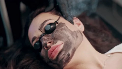 Carbon face peel. Stock Footage 237885505
