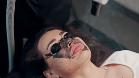 Carbon face peel. Stock Footage 238714532