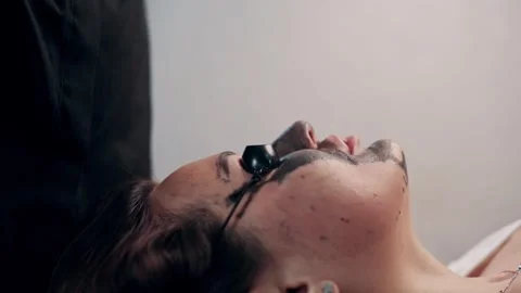 Carbon face peel. Video stock 240137571