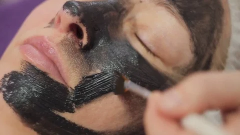 Carbon face peeling procedure. Laser pulses clean skin of the face. Hardware Stock Footage 82710091