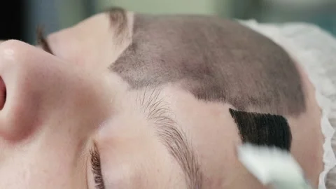 Carbon peeling. Close-up Stock Footage 92970156