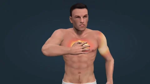 Cardiac arrest Vídeos de archivo 263150979