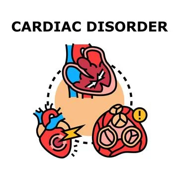 Cardiac disorder vector concept creating health problems Stock Illustration