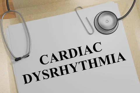 CARDIAC DYSRHYTHMIA concept Stock Illustration