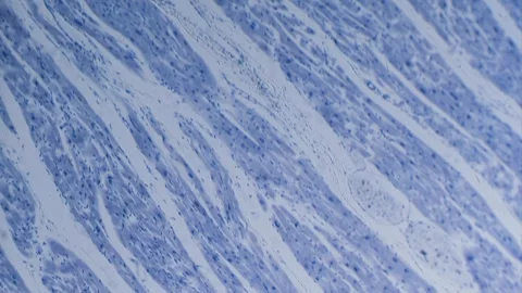 Cardiac muscle Stock Footage 291963568