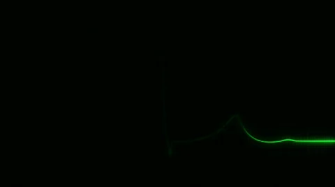 Cardiogram 2 Stock-Footage 525355