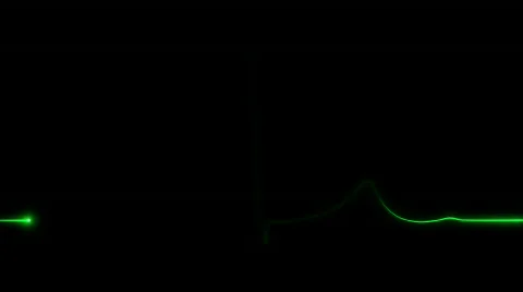 Cardiogram 3 Stock-Footage 525299
