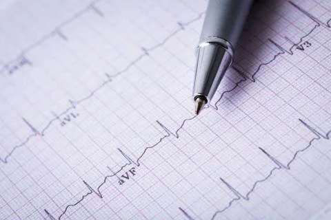 Cardiogram and technical pen Foto stock