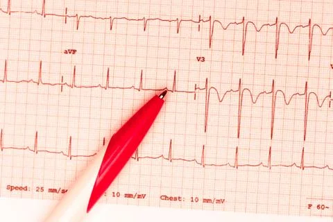Cardiogram and technical pen Stock Photos