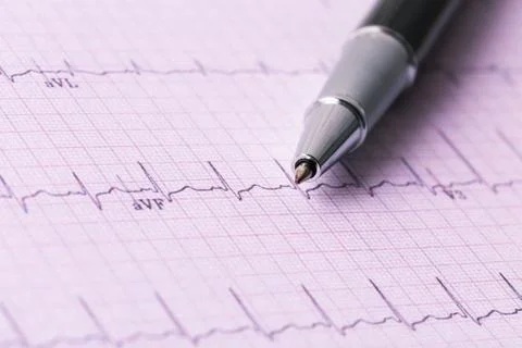 Cardiogram and technical pen Foto stock