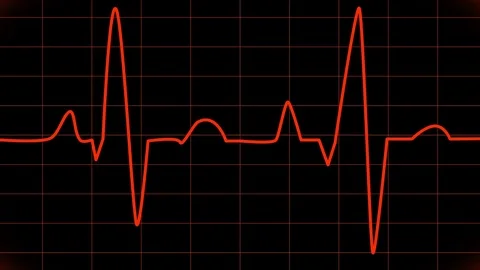 Cardiogram. Animated EKG Display Stock Footage 73405003