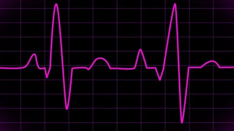 Cardiogram. Animated EKG Display Stock Footage 73405072