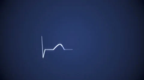 Cardiogram Background in Blue. Video stock 58812418
