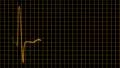 Cardiogram cardiograph oscilloscope screen with grid orange yellow loop HD Footage