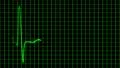 Cardiogram cardiograph oscilloscope screen with grid green loop HD Footage