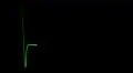 Cardiogram cardiograph oscilloscope screen loop 4k 4k or 4k+ Resolution