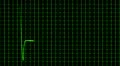 Cardiogram cardiograph oscilloscope screen loop 4k 4k or 4k+ Resolution