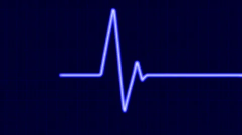 Cardiogram 動画素材 303651