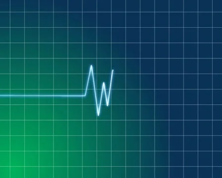 Cardiogram 스톡 동영상 511594