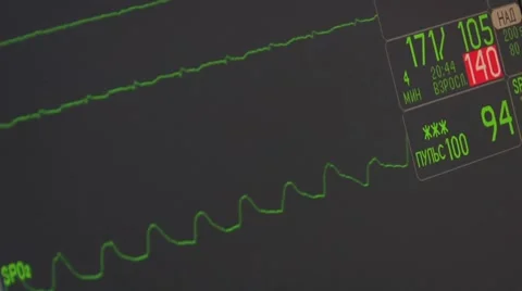 Cardiogram Video stock 7730701