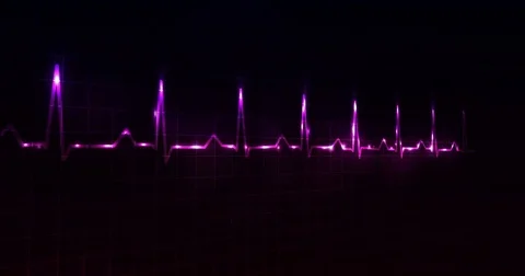 Cardiogram Stock Footage 71534478