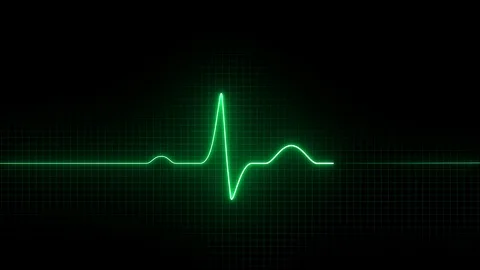 Cardiogram Stock Footage 104864990