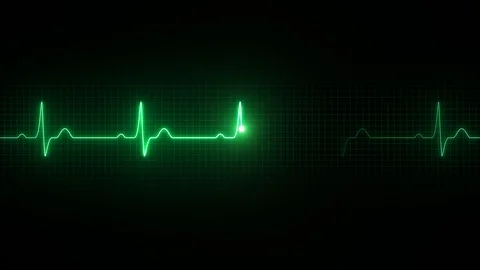 Cardiogram Stock Footage 115955219