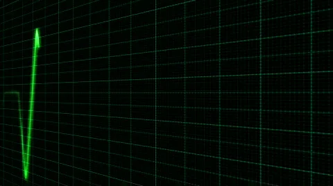 Cardiogram Green Green Video stock 873877