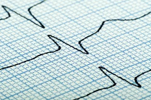 Cardiogram of heart beat Stock Photos