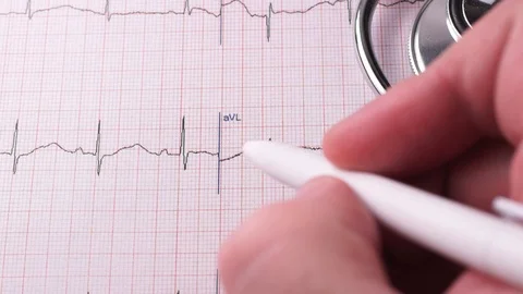 Cardiogram of the heart Stock Footage 121523606