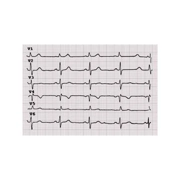 Cardiogram. Heartbeat. The graph on graph paper. Vector illustration on isolated Ilustración de archivo